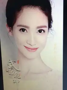 于正疑力挺金晨受了委屈就该说出来
