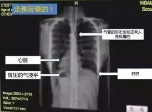 太阳的后裔中宋仲基的急救操作能得几分
