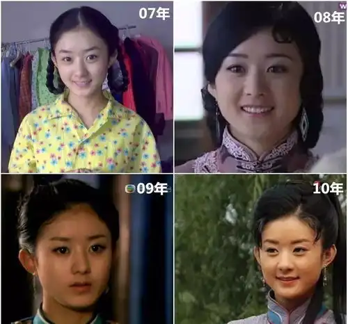 荧屏女王赵丽颖的整容史,简直是一本行走的教科书
