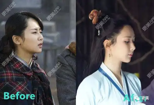 香蜜坐实杨紫整容实锤脸上线头都跑出来了
