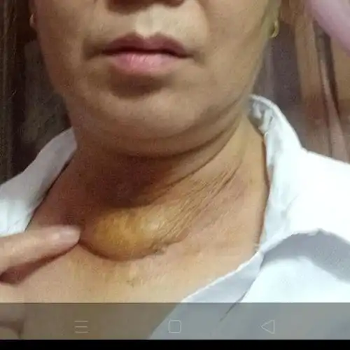 亲历医疗纠纷的至暗时刻
