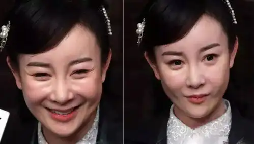 张檬哭诉因整容事业被冷藏,那辣目洋子为什么能赢赞美
