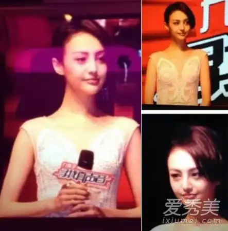 郑爽克里斯托肖强和孙菲菲整形后更丑了照片
