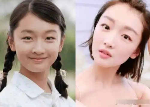 偷割双眼皮的女星,张雨绮周冬雨很成功,唯独她颜值下跌了