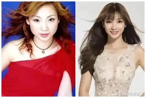 脸肿嘴歪鼻子尖,明星整容后遗症,一个比一个吓人