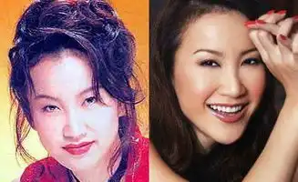 郑爽承认整容吓坏杨幂,何洁柳岩变美,金莎清纯不再,她变残了
