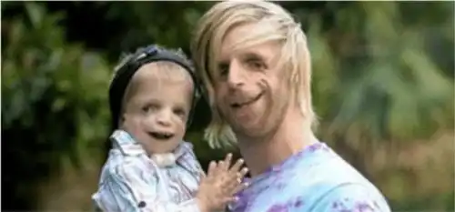 他先天脸部畸形,凭才华娶窈窕淑女,孩子出生之后,两人没了笑容