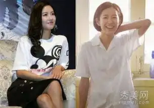 张子萱承认整容昔日对比照曝光网友面部太僵硬