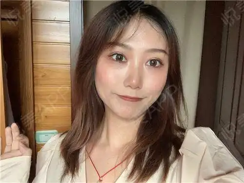 搞了个温柔可爱的蜜桃少女妆,嘻嘻,每天都要做个少女...眼综合整形悦美整形
