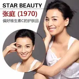 女星年过40真的不老6位女神都爱美容针
