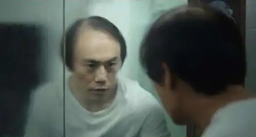 生发植发假发,隐秘角落的黄金和韭菜