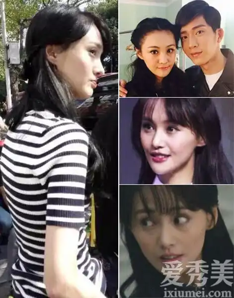 将女明星整容前后的照片与整容前后的照片进行对比
