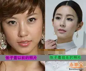 张子萱承认整容,张子萱匆匆那年剧照,张子萱现任男友是谁