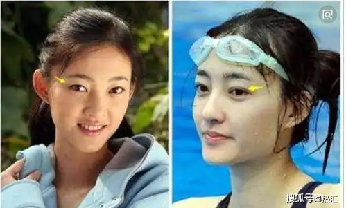 割过双眼皮的8位明星戚哥肿成羊肉串,周冬雨秒变小仙女