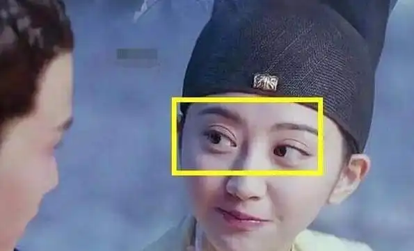 景甜自曝整容,双眼皮埋线肿成悲伤蛙,这么real真的好吗