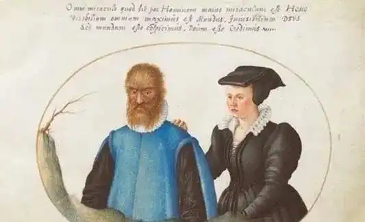 美女与野兽的故事知道吗其实这个故事在现实中是真实存在的
