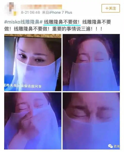李涛杨紫整容了吗削骨到垫鼻很明显了
