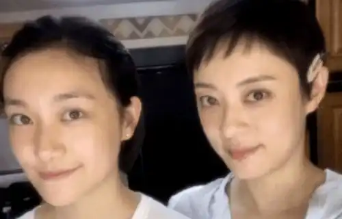 孙俪妹妹晒素颜照,孙艳下巴冒有青春痘,被网友吐槽纯路人