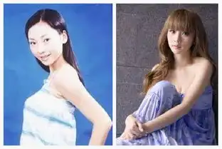 柳岩整容前后照片对比自曝情史曾被人渣前男友抛弃