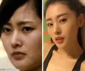 太子妃升职记大结局解析演员遭扒张天爱整容竟曾和金秀贤合作过
