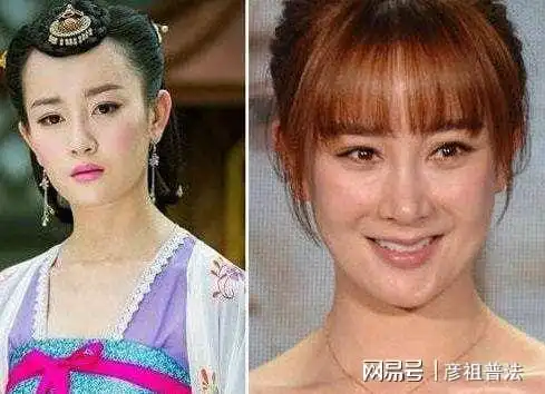 过度整容的几位明星,面部僵硬很怪异,因动脸毁了自己的事业