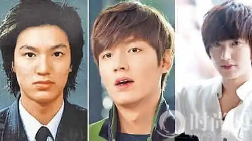 整没整过看孩子韩星都有整容史