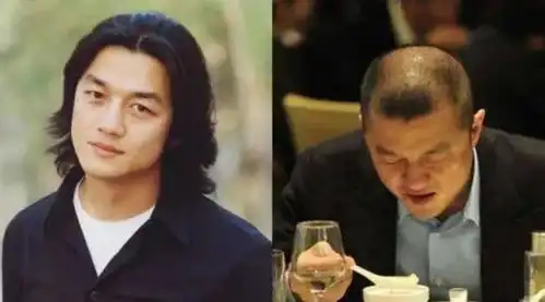 娱乐圈的秃头队伍又壮大了
