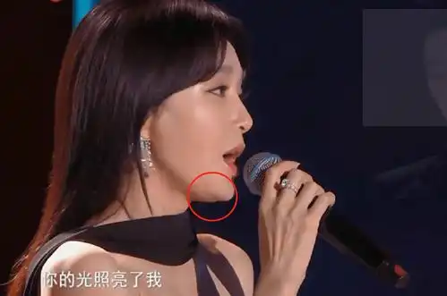 99晚会无滤镜生图景甜嘴歪秦岚发福,段奥娟脸颊痘印显粗糙
