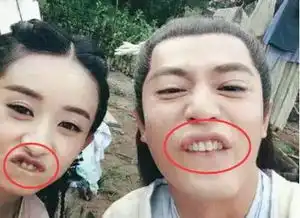霍建华新照一口老黄牙抢镜,可赵丽颖牙齿怎么比他还黄