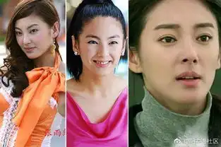 郑爽,薛之谦大方承认整容,其余明星不承认,表示只是割个双眼皮
