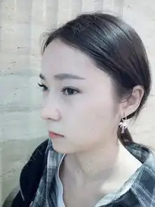 快两个月了,鼻子越来越稳定了,从不同的角度拍过照片...鼻综合悦美整形
