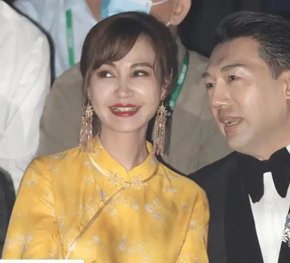 6位天然美女非得整容,满脸硅胶,难看又老气
