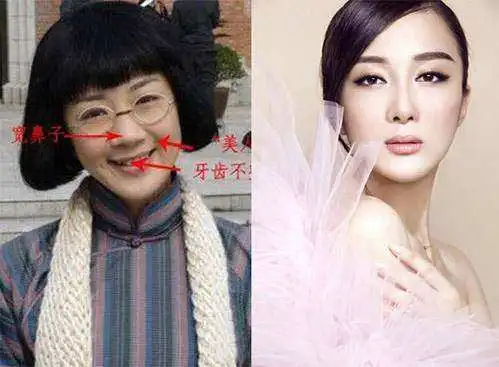 她与赵丽颖搭戏没红,却凭杨幂扶摇人气大涨,自曝整容5次
