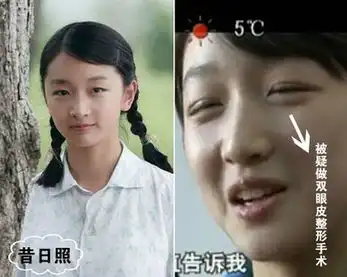 娱乐圈整容风潮周冬雨整过容吗周冬雨剧照对比
