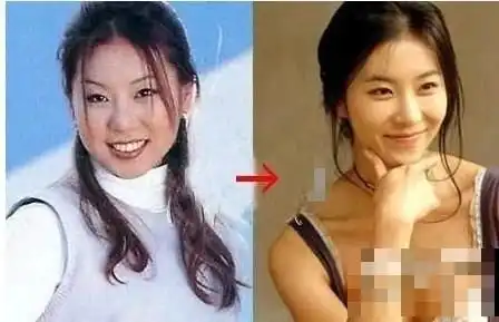 曝韩国女星整容变脸对比照
