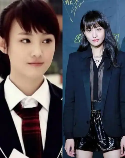 整容女星盘点郑爽丧失灵气张檬张萌网红感,她让人意难平