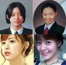 少女时代郑丽媛tara盘点韩国女星整容后遗症