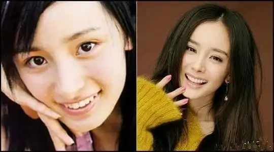 整牙整出锥子脸,杨幂李冰冰的话你信吗