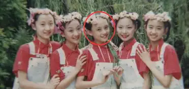 孙俪嘴唇下的痣引关注系因严重车祸造成