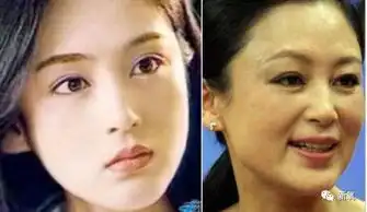 为什么割完双眼皮反而显老试着给周冬雨p成大外双后