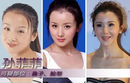 杨幂姚笛佟丽娅郑爽柳岩女星整容前后照片大对比组图