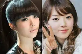 中韩女星整容失败案例小苹果裴涩琪李多海郑爽萧蔷
