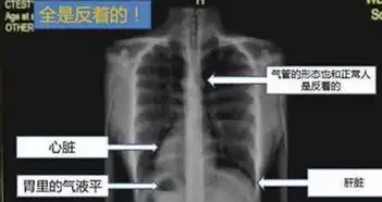 太阳的后裔大结局扒一扒惊呆网友的十大穿帮镜头组图
