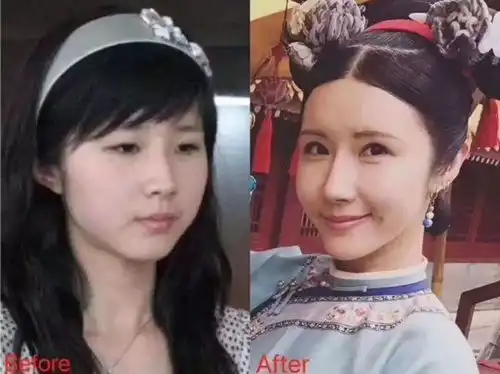 八大处专家赵延勇,揭秘延禧攻略中整容脸为何表情僵硬
