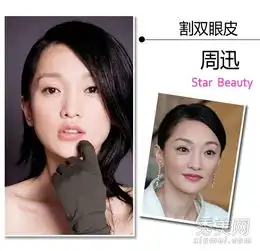 周迅郑爽何洁侯佩岑15位女星公开整容部位
