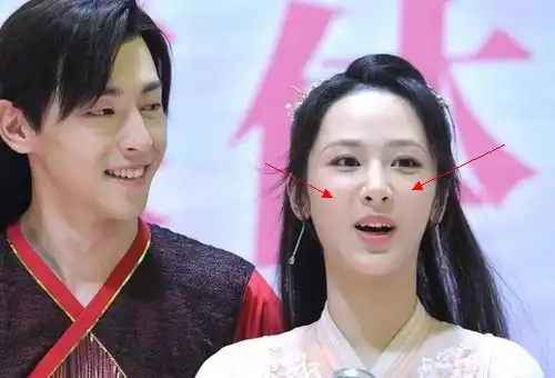 杨紫已经把脸填成这样了,法令纹还是这么明显