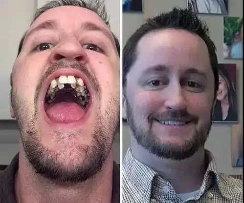 一群曾经牙齿丑得不忍直视的网友,在下定决心整牙后,就这么华丽丽逆袭了...