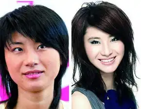 蛇精垫歪脸露手术疤图揭赤裸裸换脸的女星
