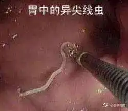 一条海鱼里竟检出22条寄生虫吃进肚子后果严重