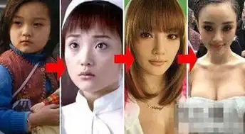 比杨紫频频换脸更可怕的是娄艺潇的脸也成了谜
